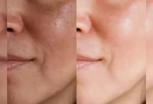 Glowing Face Naturally 5 Tips: உங்கள் முகம் இயற்கையாக பொழிவு பெற உதவும் இயற்கையான அழகு குறிப்புகள்