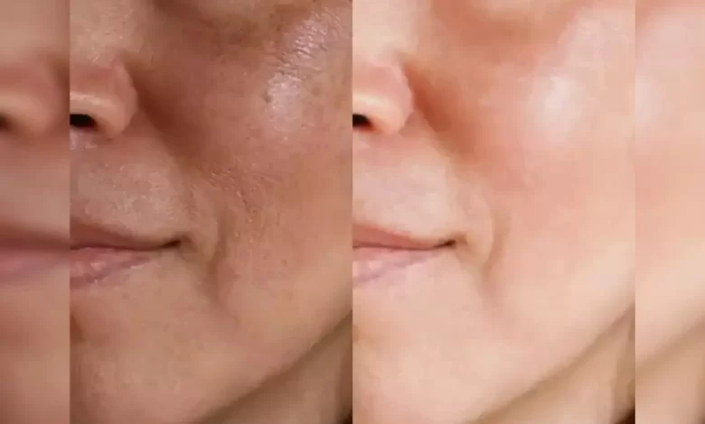 Glowing Face Naturally 5 Tips: உங்கள் முகம் இயற்கையாக பொழிவு பெற உதவும் இயற்கையான அழகு குறிப்புகள் Glowing Face Naturally 5 Tips: உங்கள் முகம் இயற்கையாக பொழிவு பெற உதவும் இயற்கையான அழகு குறிப்புகள்