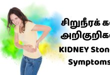 கிட்னி ஸ்டோன் வீட்டில் தீர்வு