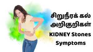 கிட்னி ஸ்டோன் வீட்டில் தீர்வு